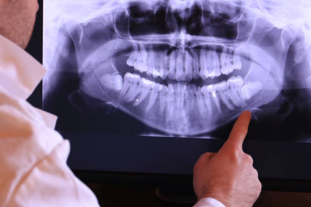 Best Emergency Treatment for Oral Infections in Westminster, LA